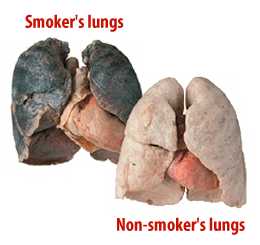 smoker's lungs